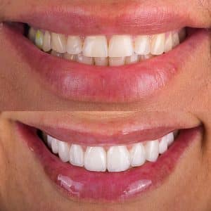 w dental clinic istanbul turkey
