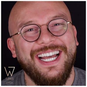 w dental clinic istanbul turkey
