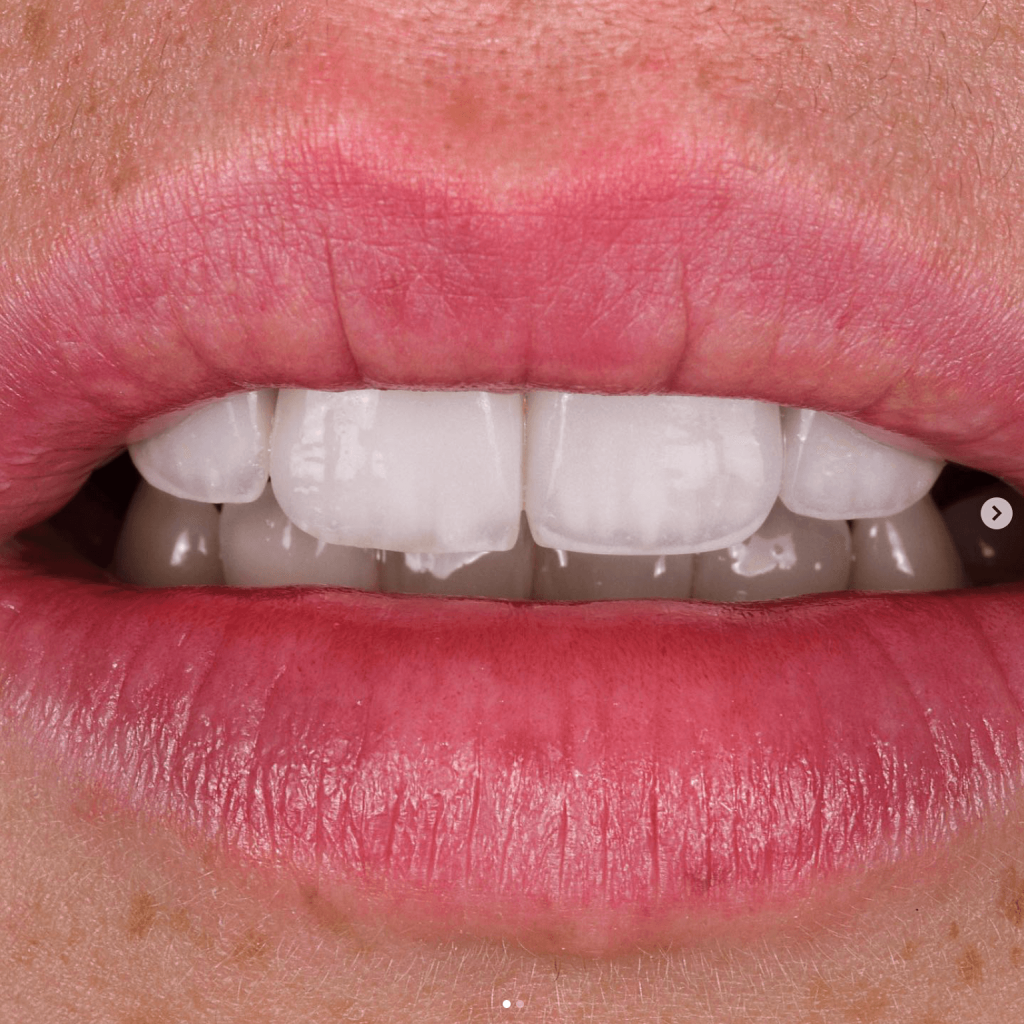 Can you trust dentist in Turkey?