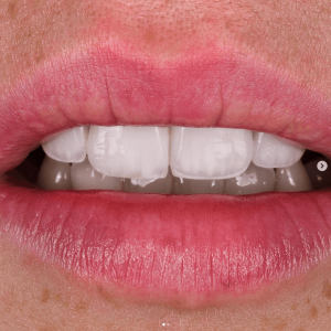 Can you trust dentist in Turkey?