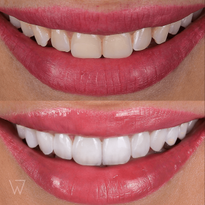 w dental clinic istanbul turkey