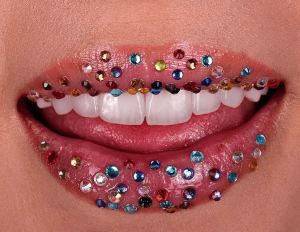 non prep veneers in istanbul