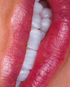 dental categories