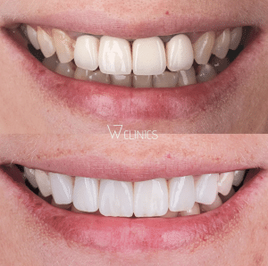 w clinics dental treatment prices