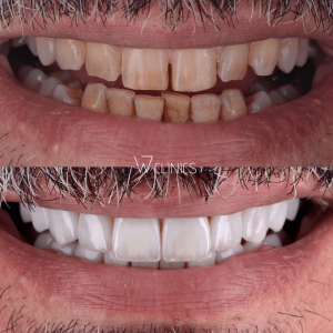 w dental clinic istanbul turkey