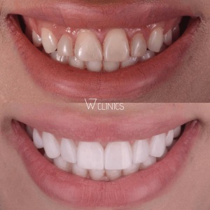 w dental clinic istanbul turkey