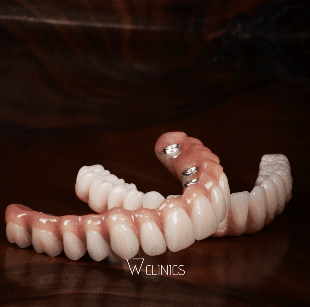 full mouth restoration istanbul