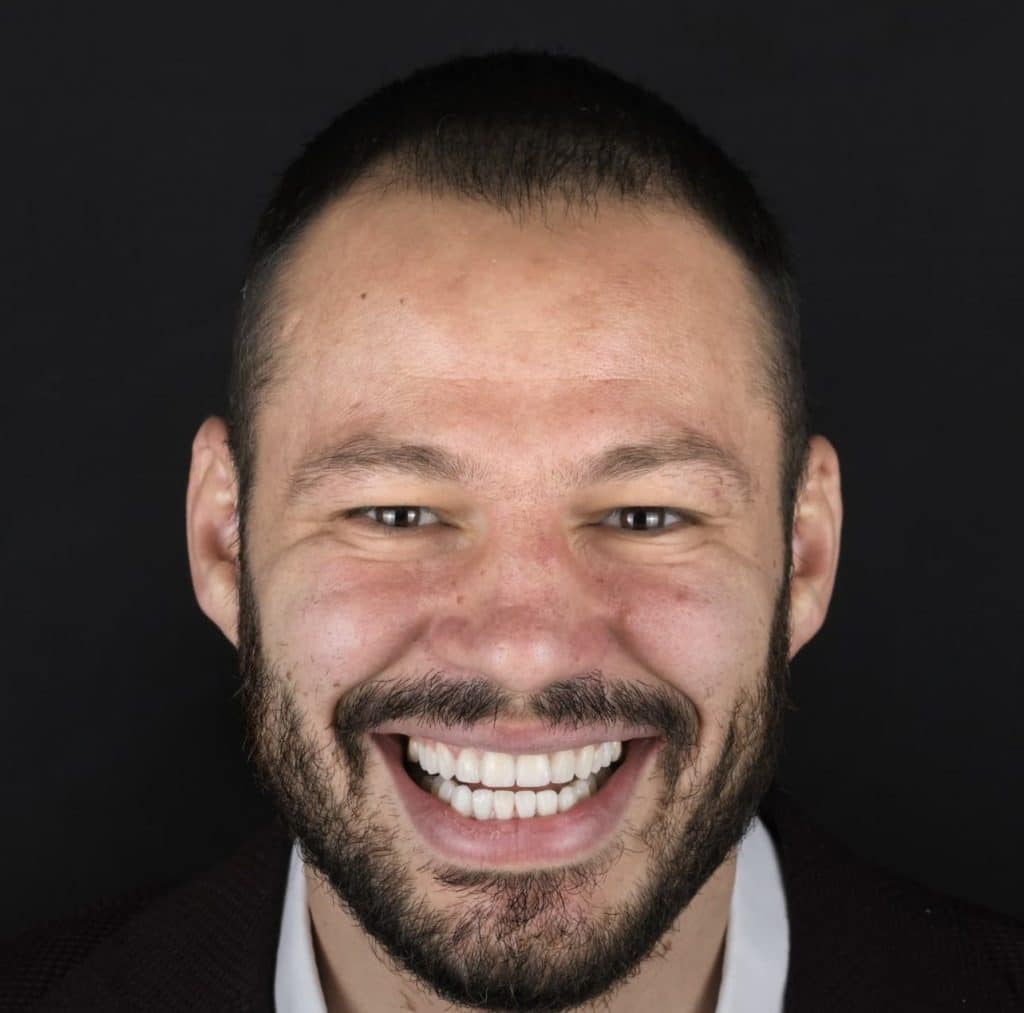 best dentist in turkey