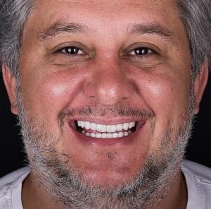 w clinics dental treatment prices 3