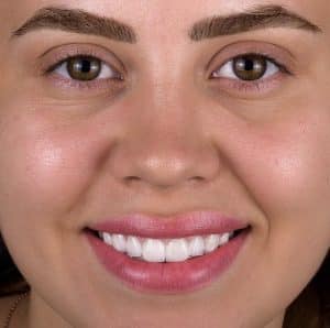 w clinics dental treatment prices 4